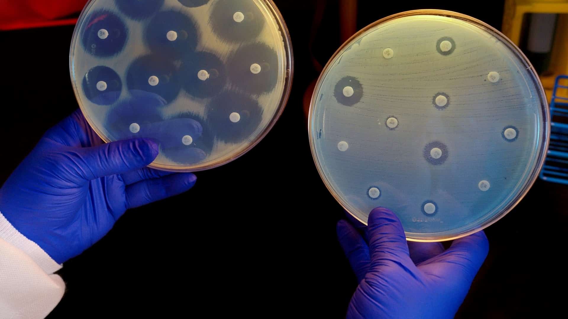 umela inteligencia vynasla antibiotikum